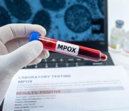 ABD’de Mpox’un yeni varyantından ilk vaka bildirildi