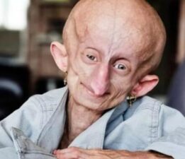 Her doğum gününde 8 yıl yaşlandı! TikTok fenomeni ‘152’ yaşında öldü