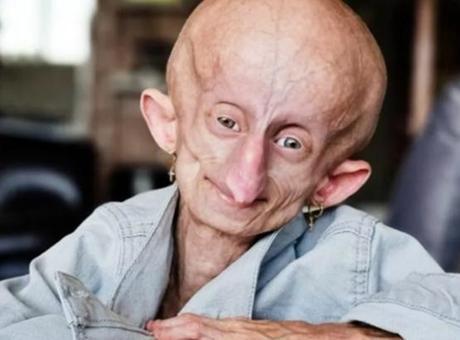 Her doğum gününde 8 yıl yaşlandı! TikTok fenomeni ‘152’ yaşında öldü