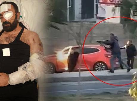 Silahlı kavgada yaralanan dernek başkanı: Dokuz canlıyım çok şükür