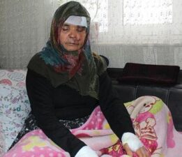 Kızını ziyarete giden anne ve baba dehşeti yaşadı! ‘Beni parçalayacaktı’