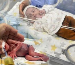 Mucize görüntü: 380 gram doğan Hira Su bebeğin yaşama sarılışı