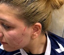 Tur atladılar dayak yediler: Güneşin Çocukları Hentbol Takımı’na çirkin saldırı