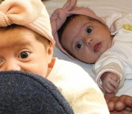 Prematüre doğdu, 1 haftalıkken teşhis kondu! Miray bebeğin 1 milyon 870 bin dolara ihtiyacı var