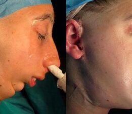 13 yıl ağzını açamadı, 28 kiloya düştü! Türk hekim mucize operasyon