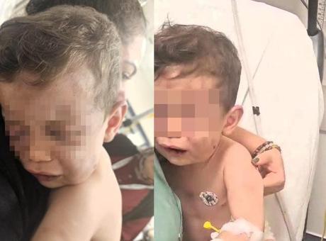 2 yaşındaki bebek annesinin erkek arkadaşı tarafından öldüresiye dövüldü