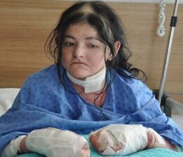 ABD’den geldi, şifayı Eskişehir’de buldu! Anne Natali: Kızımın hayatı değişti