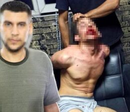 Dişleri kırılıp, hamam böceği yedirildi! 3 günlük işkencede şok rapor
