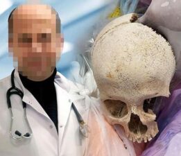 Adana’daki çöpten kafatası çıkmıştı! Doktorun yıllardır sakladığı sır