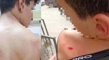 Ankara’da dehşet! 14 yaşındaki çocuğu öldüresiye dövdü
