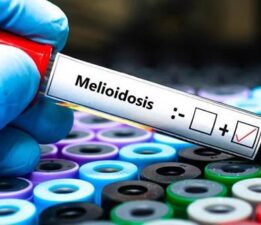 Avustralya’da melioidoz salgını! Can kaybı 31’e çıktı