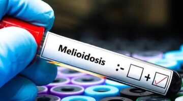 Avustralya’da melioidoz salgını! Can kaybı 31’e çıktı