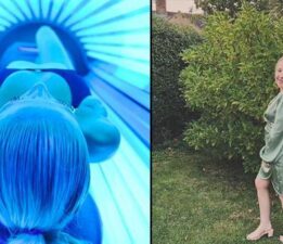 Bronzlaşmak isterken kanser oldu! Solaryum hayatını kararttı