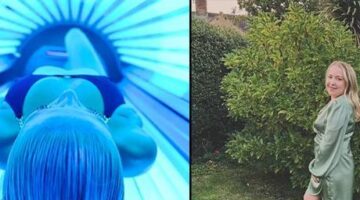 Bronzlaşmak isterken kanser oldu! Solaryum hayatını kararttı