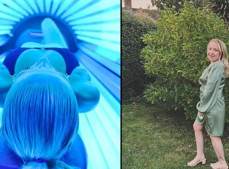 Bronzlaşmak isterken kanser oldu! Solaryum hayatını kararttı