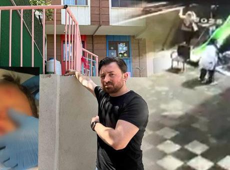 Kreşte skandal olay! ‘Ufak bir kaza’ diye aradılar, aile gerçeği öğrendi şoka girdi