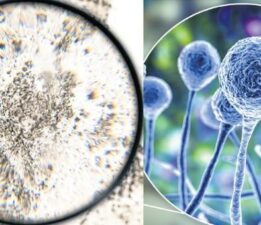 Mantar kâbusu! Akciğerleri tüketen Aspergillus küresel ısınmayla yayılıyor