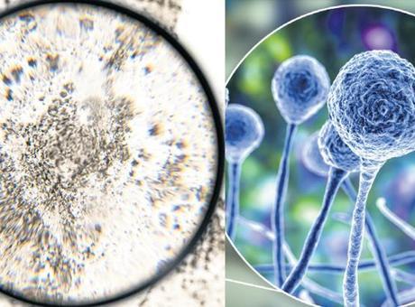 Mantar kâbusu! Akciğerleri tüketen Aspergillus küresel ısınmayla yayılıyor