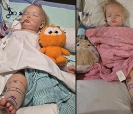 Mucize bebek! Çıngıraklı yılan tarafından iki kez ısırıldı, 30 şişeden fazla panzehir verildi