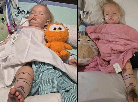 Mucize bebek! Çıngıraklı yılan tarafından iki kez ısırıldı, 30 şişeden fazla panzehir verildi