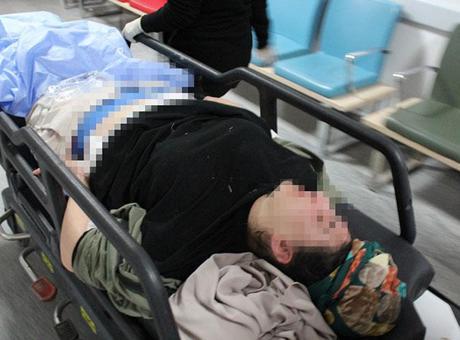 Parkta dehşet! Genç kadın babasının tabancasıyla kendini vurdu
