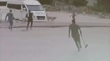 Sokak köpekleri çocuğa saldırdı