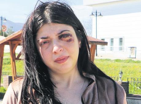Tacizin bıraktığı yara: Platinler