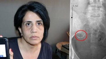 Zorla evlendirildi, hayatı kabusa döndü: Bunları hak edecek ne yaptım