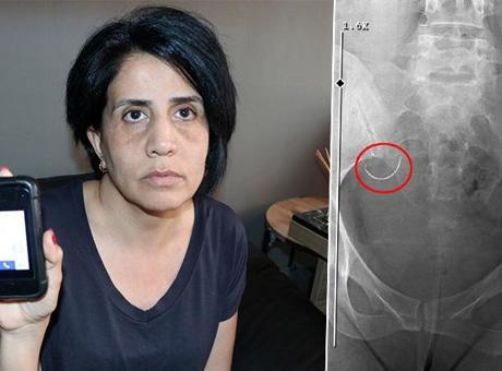 Zorla evlendirildi, hayatı kabusa döndü: Bunları hak edecek ne yaptım