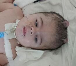 25 ayda 16 ameliyat geçirdi! Minik Ayaz yaşam mücadelesi veriyor