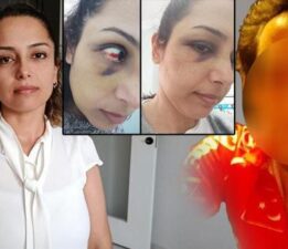 Genç öğretmenin ikinci bahar hayali kabusa döndü! ‘Hamileyken dövdü, bebeğimi kaçırdı, aracımı çaldı’
