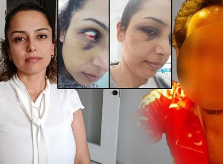 Genç öğretmenin ikinci bahar hayali kabusa döndü! ‘Hamileyken dövdü, bebeğimi kaçırdı, aracımı çaldı’