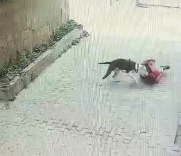 İstanbul’da çocuğa pitbull saldırdı