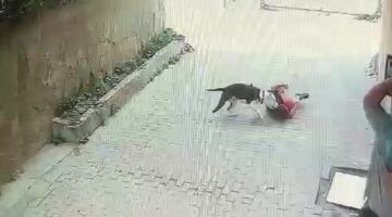 İstanbul’da çocuğa pitbull saldırdı