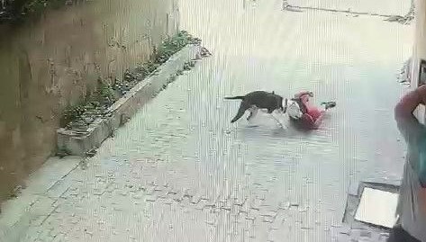 İstanbul’da çocuğa pitbull saldırdı