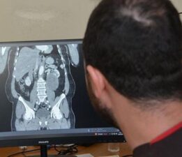 Karın şişliği için hastaneye gitti, hayatını şokunu yaşadı! ‘Neredeyse tamamını kaplamıştı’