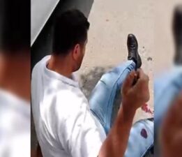 Malatya’da bir kadın kendisini rahatsız eden kişiyi ayaklarından vurup kayda aldı