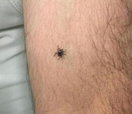 Panik büyüyor! Bir ilçede daha kene vakası görüldü