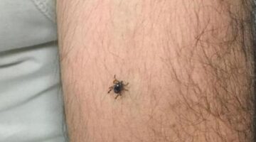 Panik büyüyor! Bir ilçede daha kene vakası görüldü