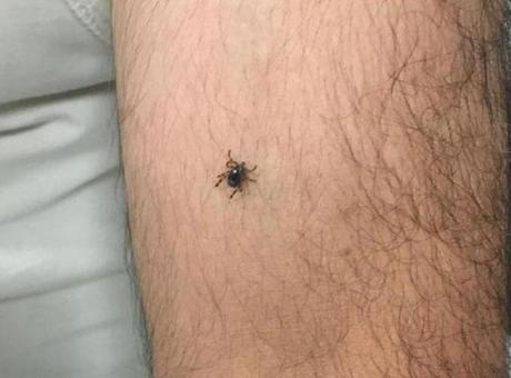 Panik büyüyor! Bir ilçede daha kene vakası görüldü