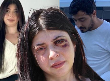 Sokak ortasında taciz edip döndü, 12 suç kaydı ortaya çıktı! Şok karar