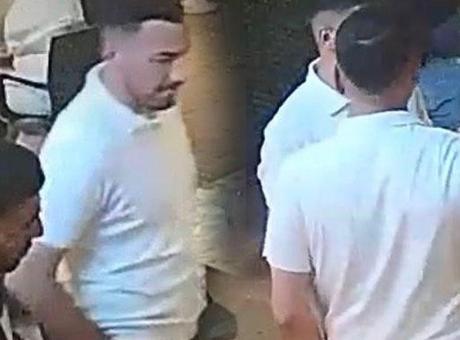 Tuvalet sırasında vahşet! Burnunu ısırıp kopardı