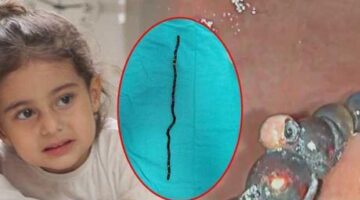 7 ay karnında taşıdı! 3 yaşındaki Berfin doktorları şoke etti! ‘Bu oyuncak değil, ölüm tuzağıymış’