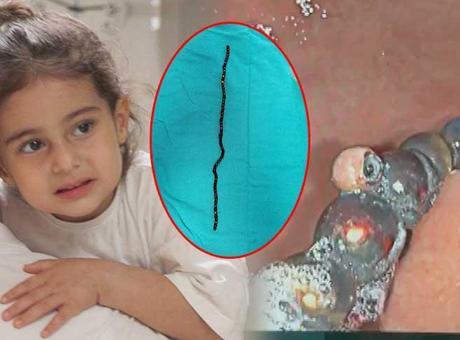 7 ay karnında taşıdı! 3 yaşındaki Berfin doktorları şoke etti! ‘Bu oyuncak değil, ölüm tuzağıymış’