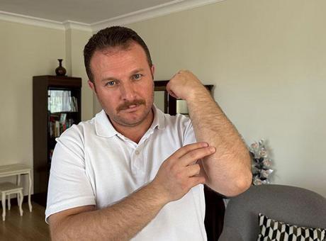 9 yıldır vücudundaki 8 şarapnel parçasıyla yaşıyor