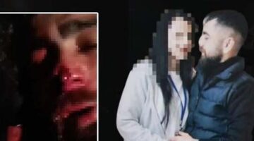 Ankara’da yasak aşk sonrası işkence! Babası ve ağabeyine yaptırdı