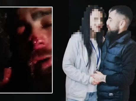 Ankara’da yasak aşk sonrası işkence! Babası ve ağabeyine yaptırdı