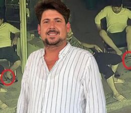 Antalya’da büyük panik! ‘Ayağında yılan var’ dedikten sonra beynim durdu