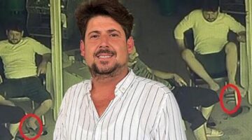 Antalya’da büyük panik! ‘Ayağında yılan var’ dedikten sonra beynim durdu