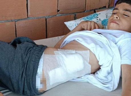 Bahçede oynayan 8 yaşındaki çocuk kanlar içerisinde yere yığıldı
